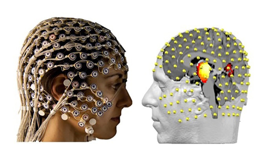 EEG